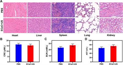 Colon cancer exosome-derived biomimetic nanoplatform for curcumin-mediated sonodynamic therapy and calcium overload